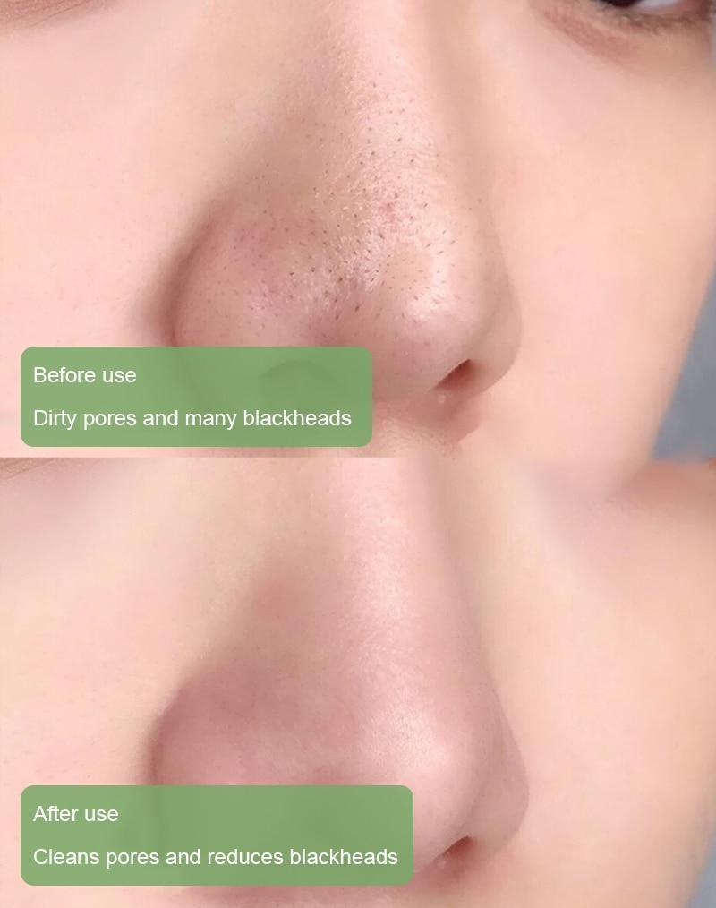 Diystar™  100% Natural Green Tea Deep Cleanse Mask