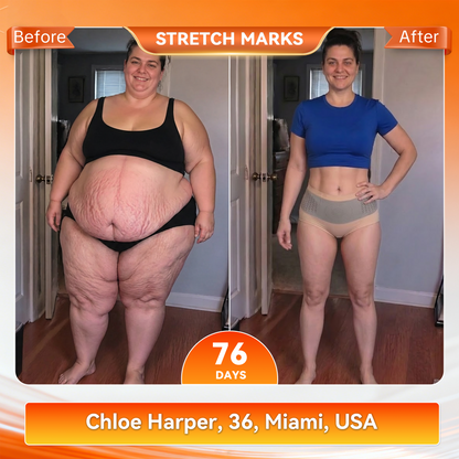 𝐎𝐟𝐟𝐢𝐜𝐢𝐚𝐥 𝐁𝐫𝐚𝐧𝐝 𝐒𝐭𝐨𝐫𝐞 🇺🇸| 𝐂𝐥𝐞𝐚𝐫𝐞𝐧𝐚® 𝟐𝟎𝟐𝟔 𝐌𝐨𝐫𝐢𝐧𝐠𝐚 x 𝐁𝐞𝐫𝐛𝐞𝐫𝐢𝐧𝐞 x 𝐍𝐀𝐃+ 𝟔-𝐈𝐧-𝟏 𝐌𝐢𝐜𝐫𝐨-𝐏𝐚𝐫𝐭𝐢𝐜𝐥𝐞 𝐒𝐜𝐮𝐥𝐩𝐭𝐢𝐧𝐠 & 𝐅𝐚𝐭-𝐁𝐮𝐫𝐧 𝐒𝐡𝐨𝐫𝐭𝐬 (Women + Men with Enhanced Male Vitality Blend)