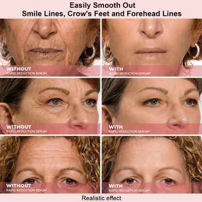 Results in 60 Seconds - Lumovelle Rapid Wrinkle-Reducing Serum for Wrinkles, Bags & Dark Circles