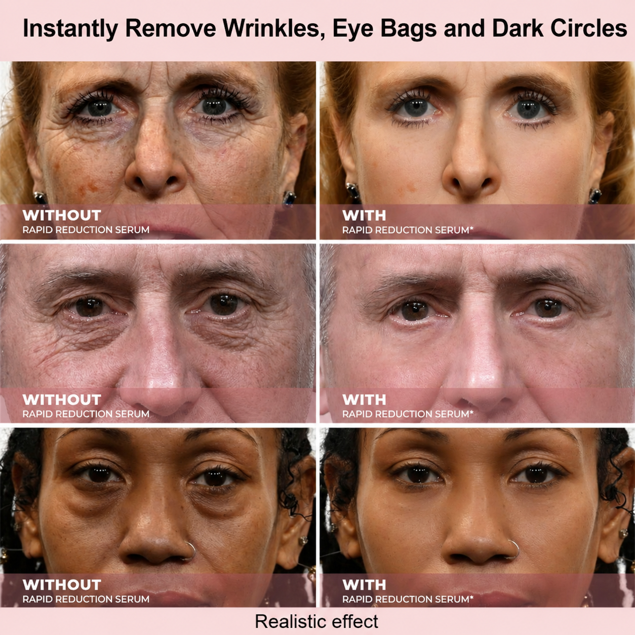 Results in 60 Seconds - Lumovelle Rapid Wrinkle-Reducing Serum for Wrinkles, Bags & Dark Circles