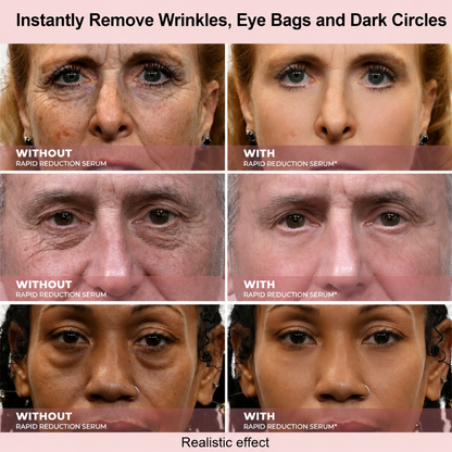 Results in 60 Seconds - Lumovelle Rapid Wrinkle-Reducing Serum for Wrinkles, Bags & Dark Circles