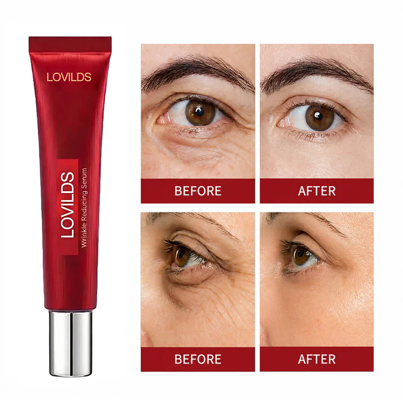 Results in 60 Seconds - Lumovelle Rapid Wrinkle-Reducing Serum for Wrinkles, Bags & Dark Circles