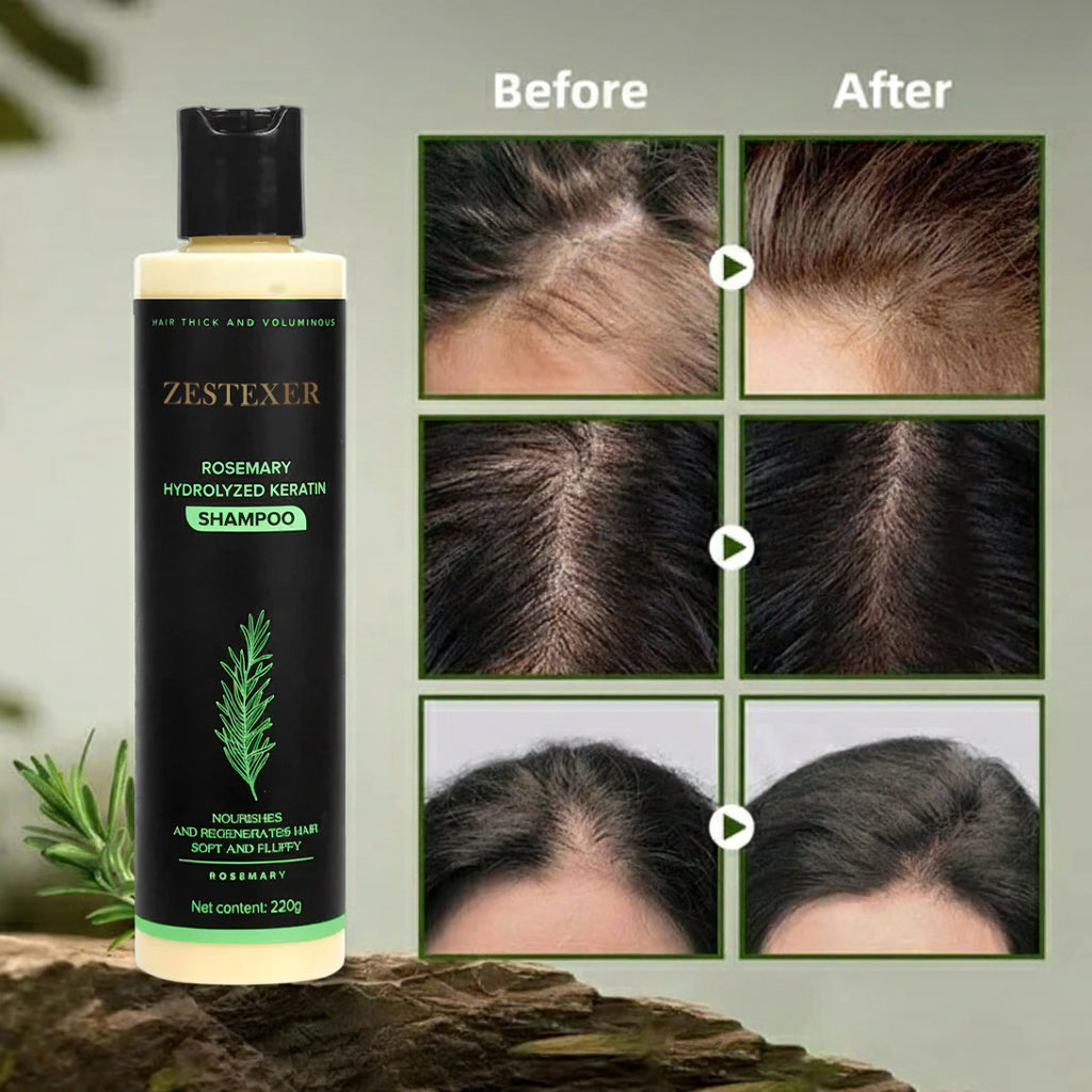 LOVILDS® Rosemary Hair Growth Shampoo