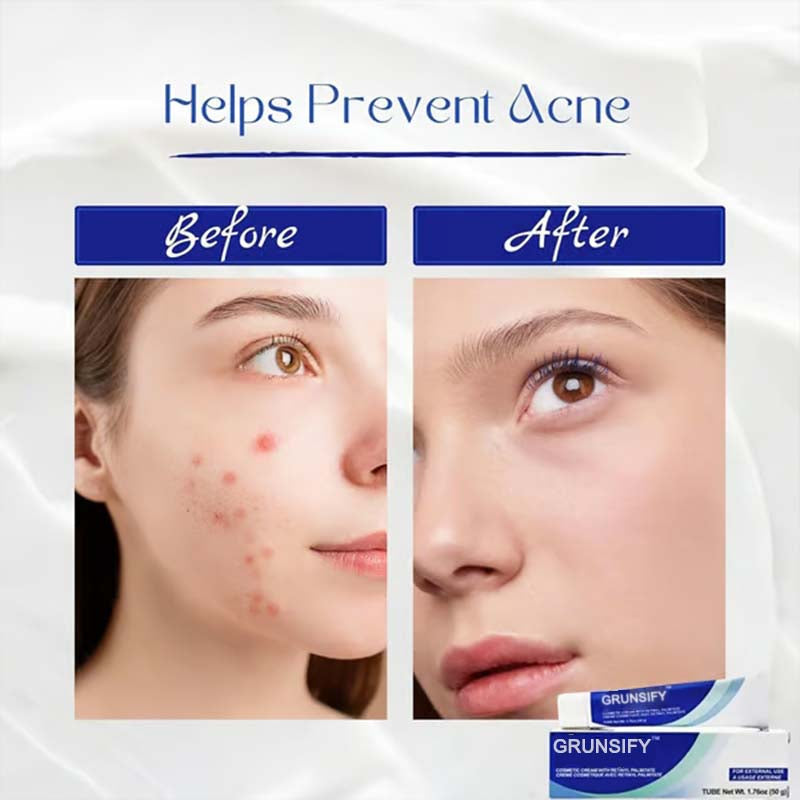 ✨Get clear, radiant skin quickly - Enjoy a 49% discount - ✨Ultimate skincare formula + hyaluronic acid - Suitable for all ages