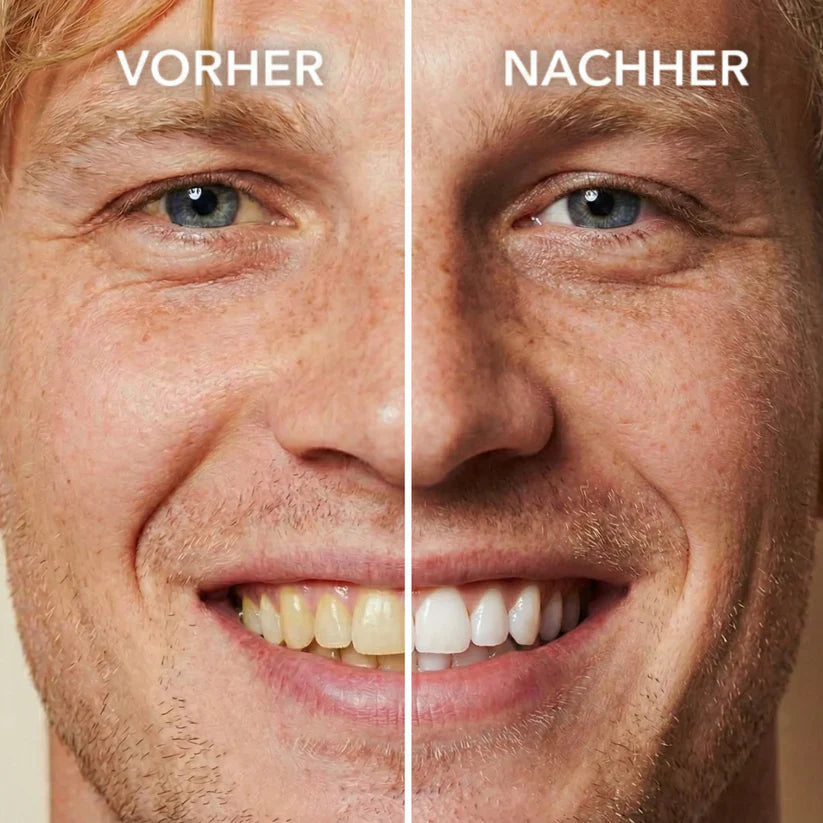 🦷Tooth Polish - Instant Clean Smile