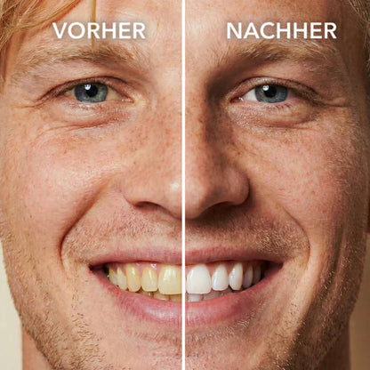 🦷Tooth Polish - Instant Clean Smile