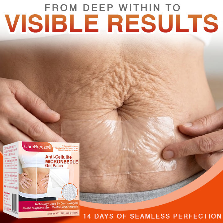✅ CareBreeze® Anti-Cellulite Microneedle Patch